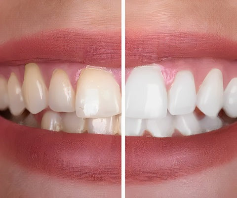BrightWhiten™ | Color-Correcting Purple Toothpaste for a Dazzling Smile