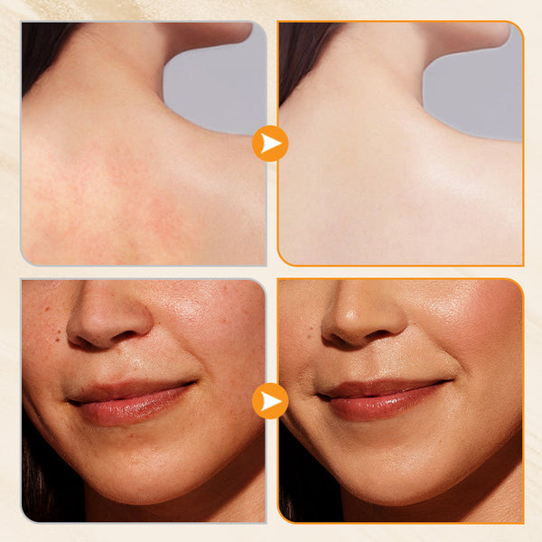 1+1 Free | TurmeriGlow™ Radiant Skin Turmeric Soap