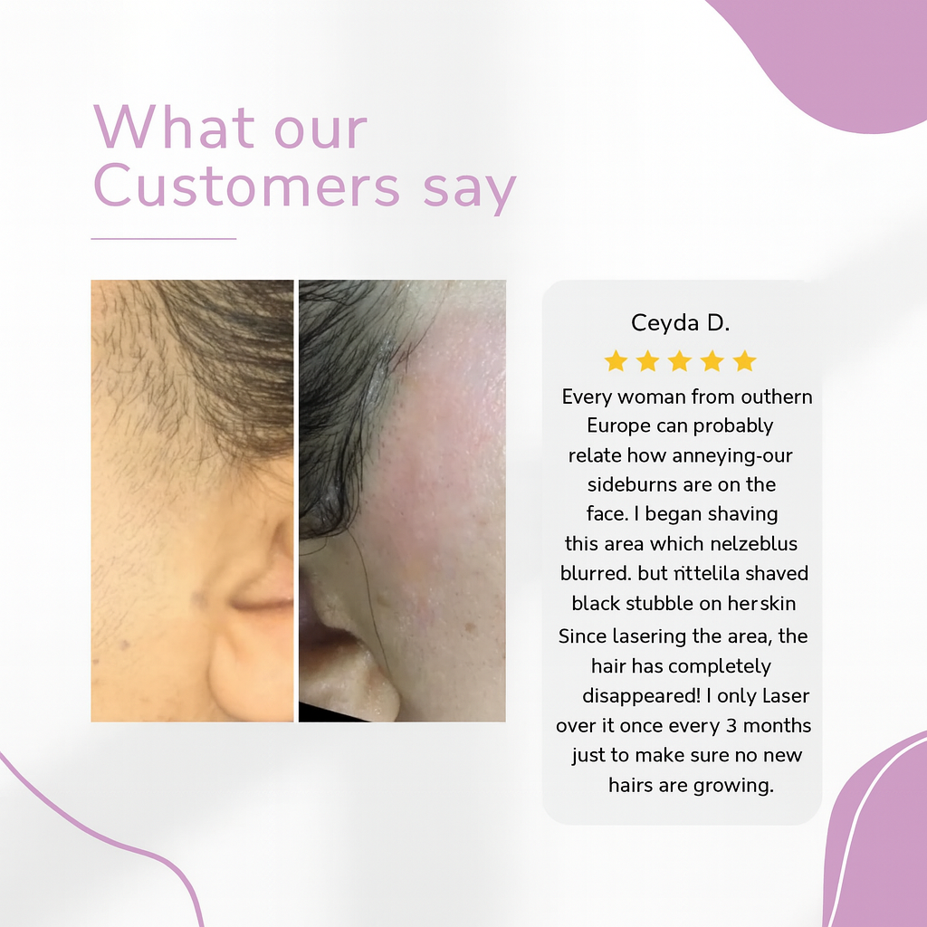 ✨ Ylvis IPL Hair Remover – Smooth, Hair-Free Skin from Home