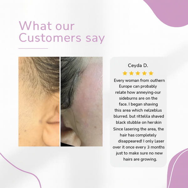 ✨ Ylvis IPL Hair Remover – Smooth, Hair-Free Skin from Home