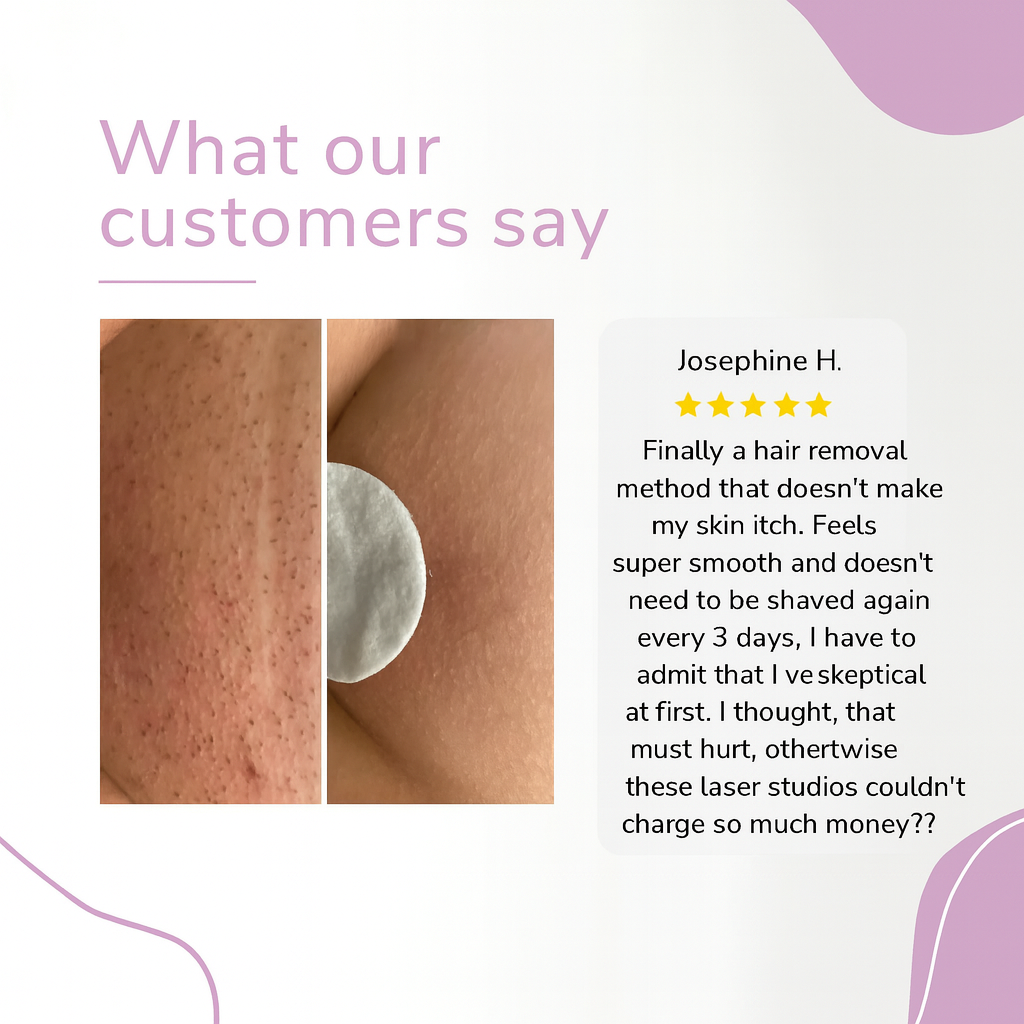 ✨ Ylvis IPL Hair Remover – Smooth, Hair-Free Skin from Home