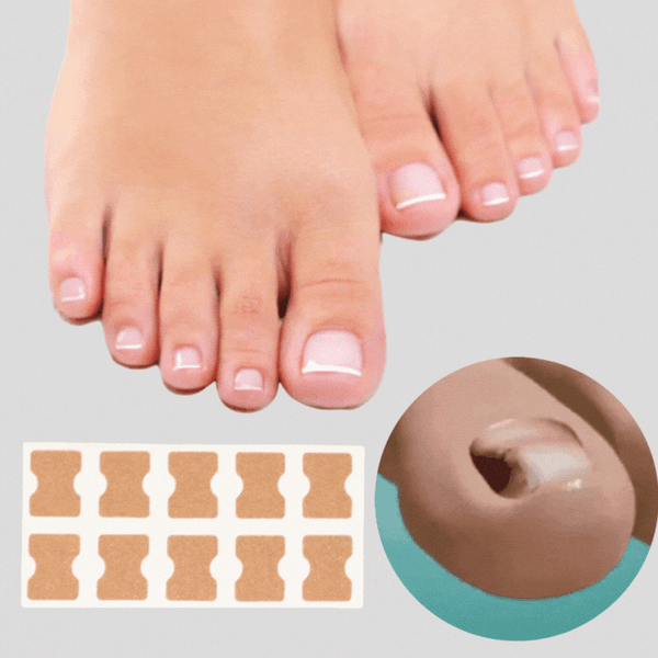 (50% Discount) FinePatches™ | Correction Patches for Beautiful and Healthy Nails