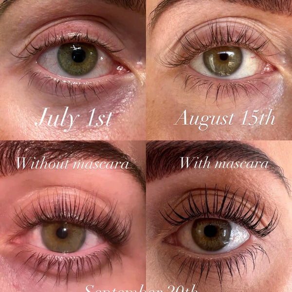 BUY 1 GET 1 FREE | Kaylash™ Growth Serum