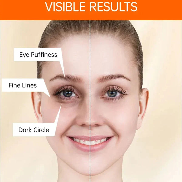 InstaLift™ Anti Wrinkle Eye Cream