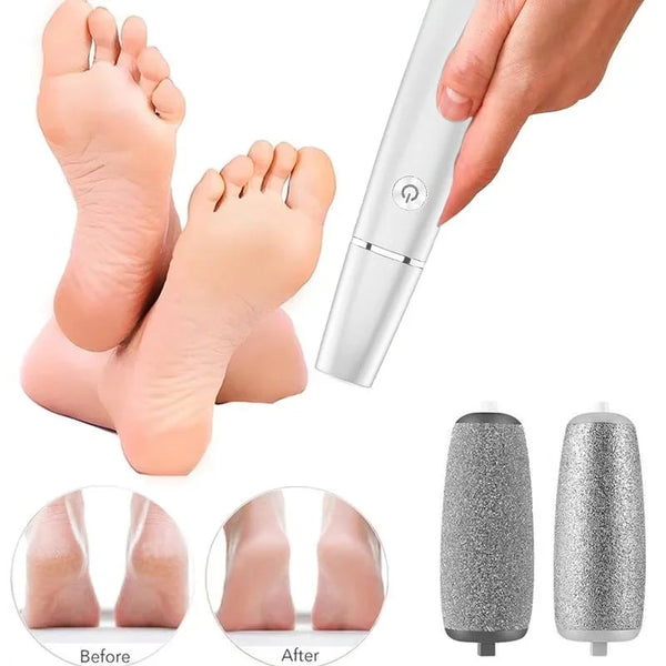 【LAST DAY SALE】Electric Foot Callus Remover