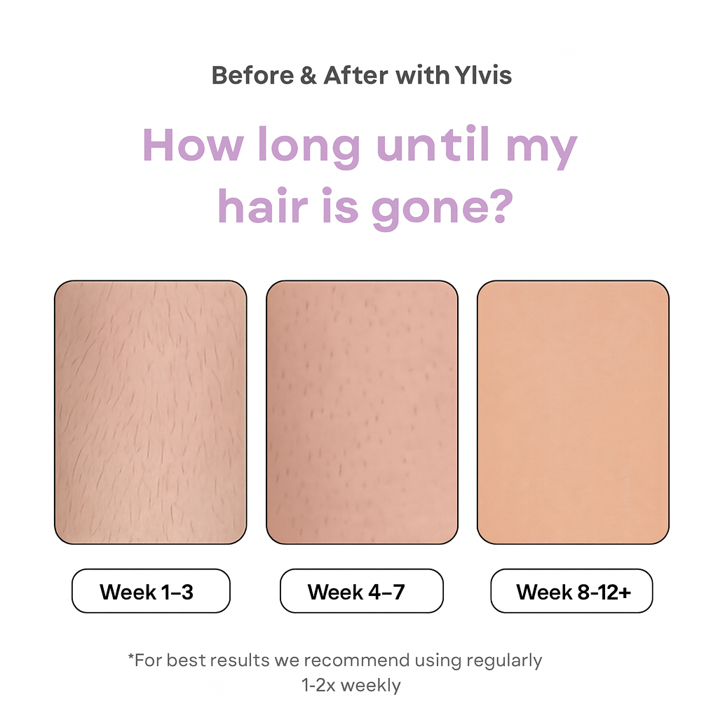 ✨ Ylvis IPL Hair Remover – Smooth, Hair-Free Skin from Home