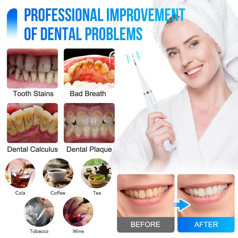 DentaPure™ – Professional Electric Teeth Cleaning at Home