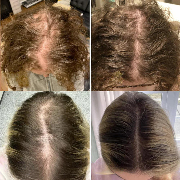 Minopia™ - A Holistic Formula Powered by Nature