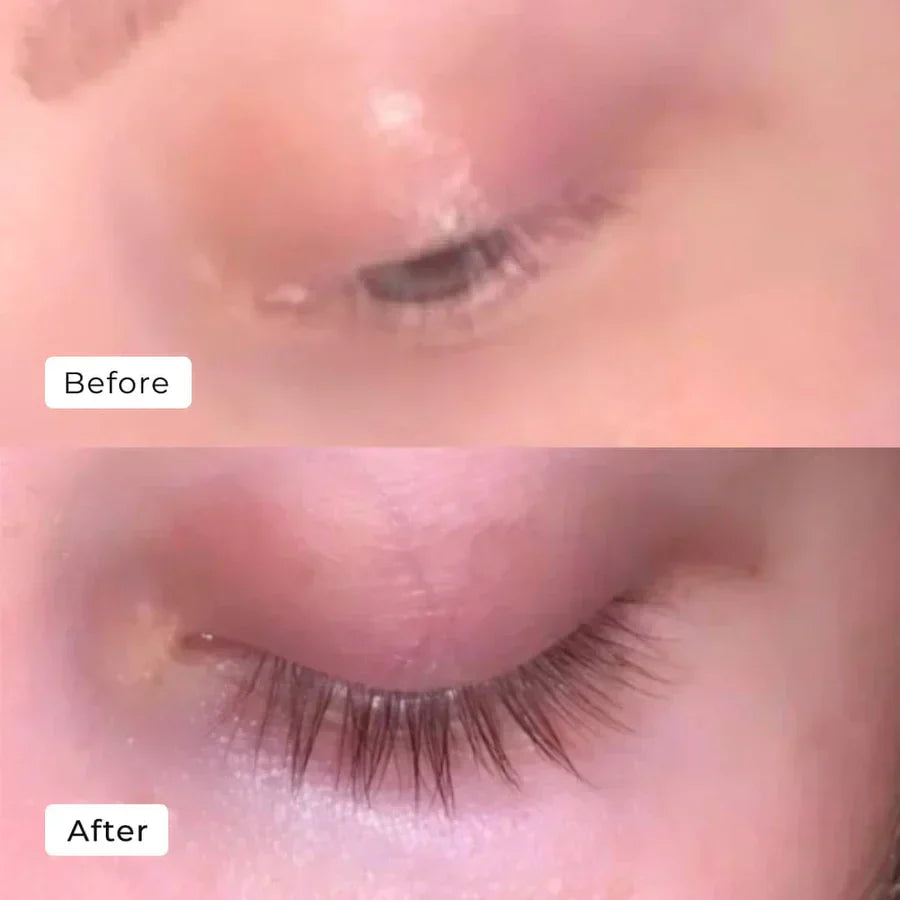 Lash Bloom™ Luxurious Eyelash Length (Buy 1 Get 1 Free)