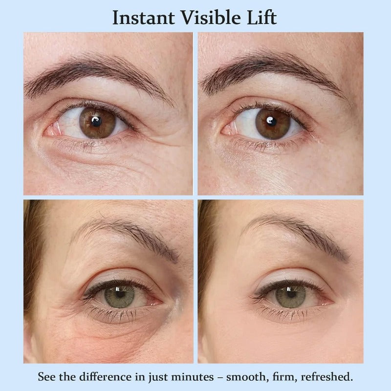 Instant Eye Lift Cream Lifts & Refreshes Tired Eyes