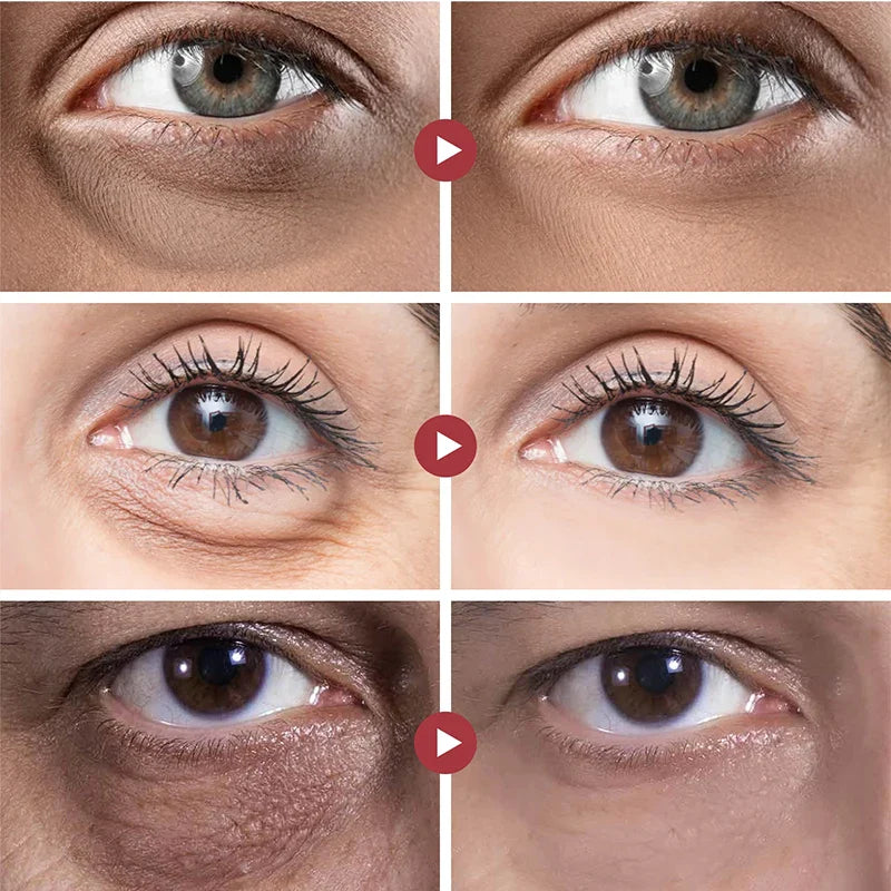 InstaLift™ Anti Wrinkle Eye Cream