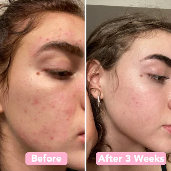 Velleara Turmeric & Kojic Acid Pads | 40 Pack | Reveal fresher, brighter skin — one pad at a time