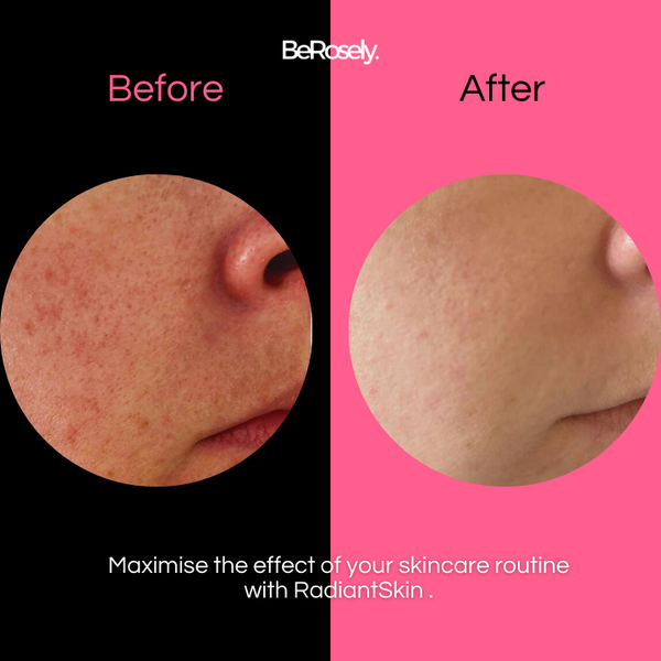 RadiantSkin™ Soft Shower Brush