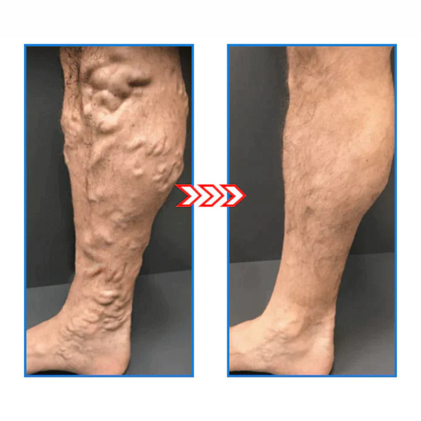 1+2 Free | FormSocks™ - Slim legs and firm skin in one step!