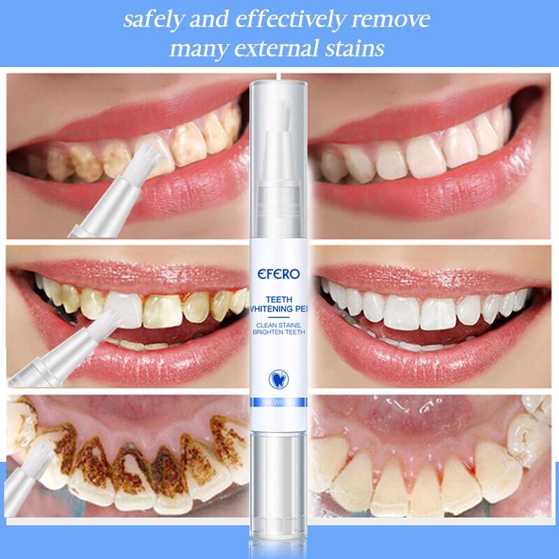 【🔥 Buy 1 Get 1 Free】 Teeth Whitening Pen