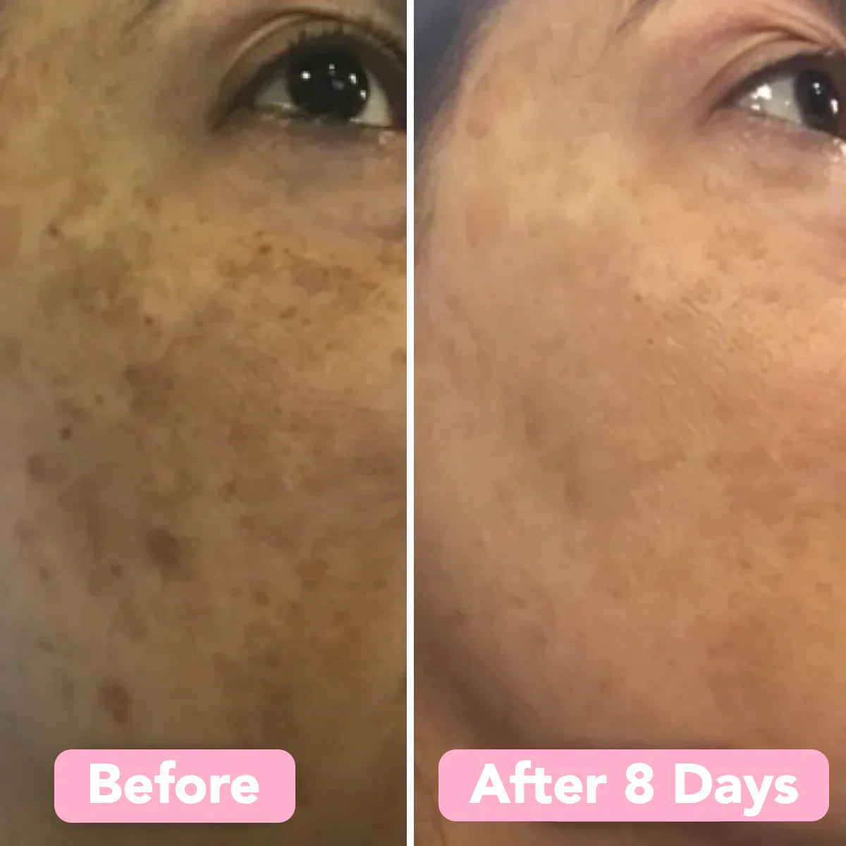 Velleara Turmeric & Kojic Acid Pads | 40 Pack | Reveal fresher, brighter skin — one pad at a time