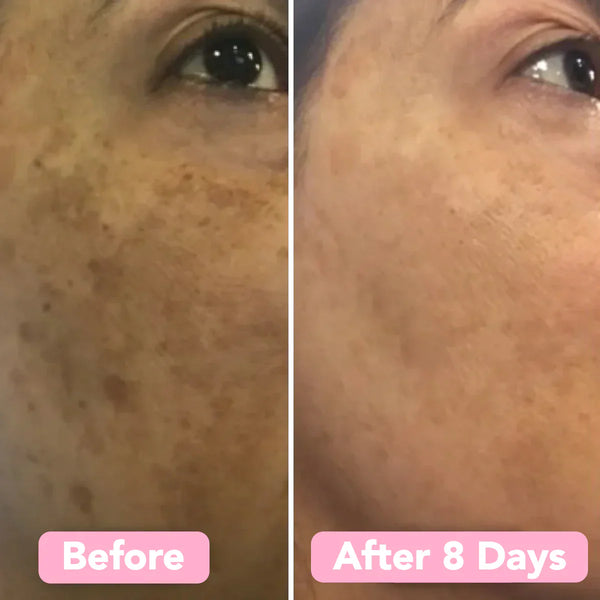 Velleara Turmeric & Kojic Acid Pads | 40 Pack | Reveal fresher, brighter skin — one pad at a time