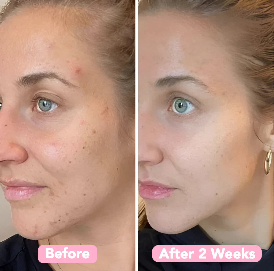 Velleara Turmeric & Kojic Acid Pads | 40 Pack | Reveal fresher, brighter skin — one pad at a time