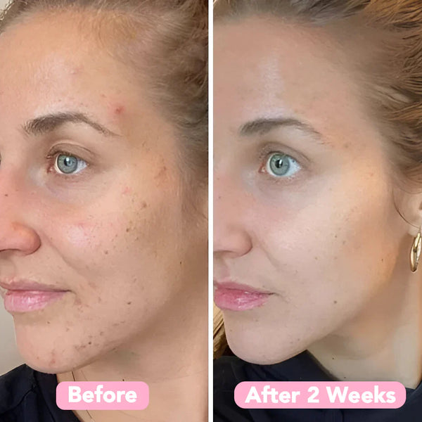 Velleara Turmeric & Kojic Acid Pads | 40 Pack | Reveal fresher, brighter skin — one pad at a time