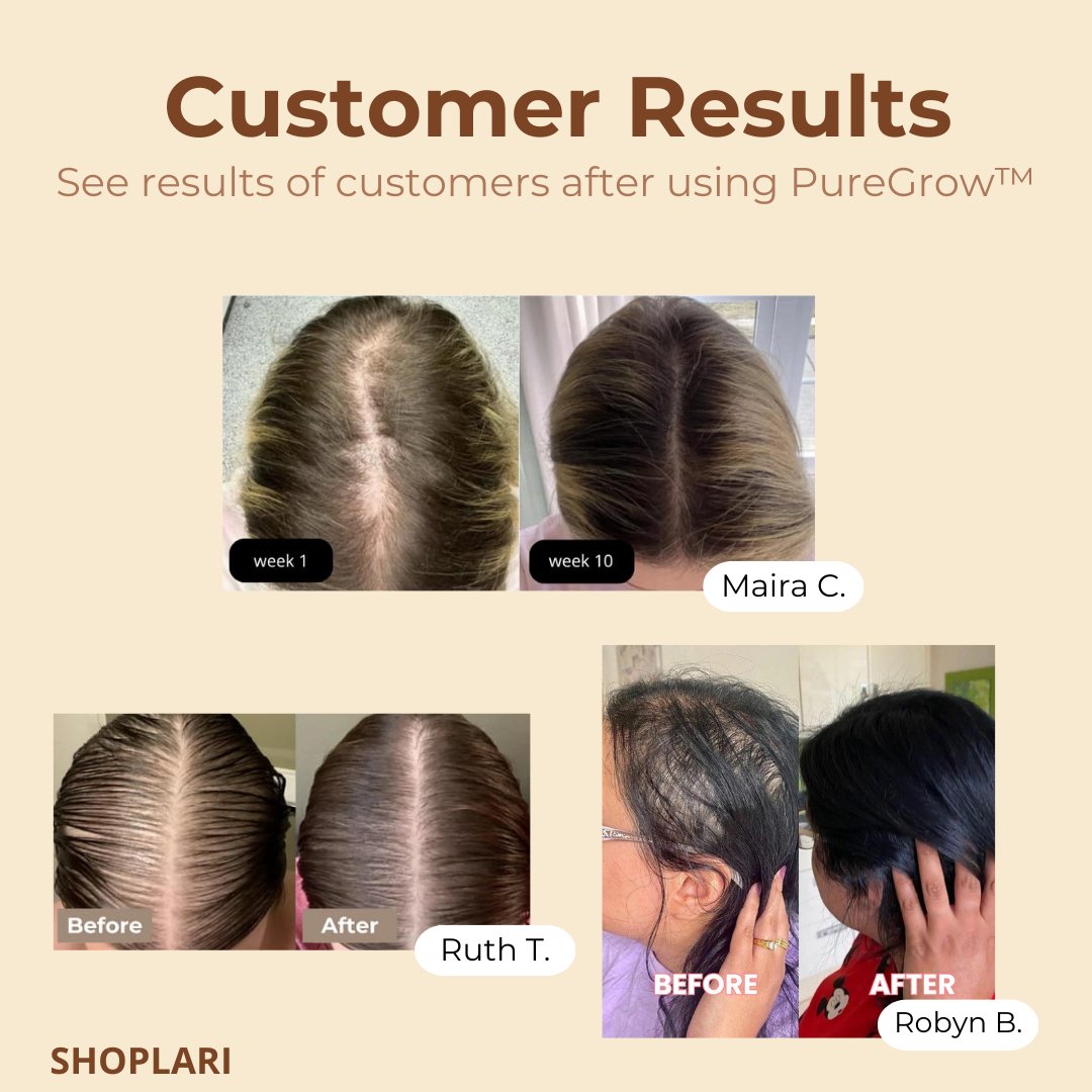 PureGrow™ Organic Batana Oil