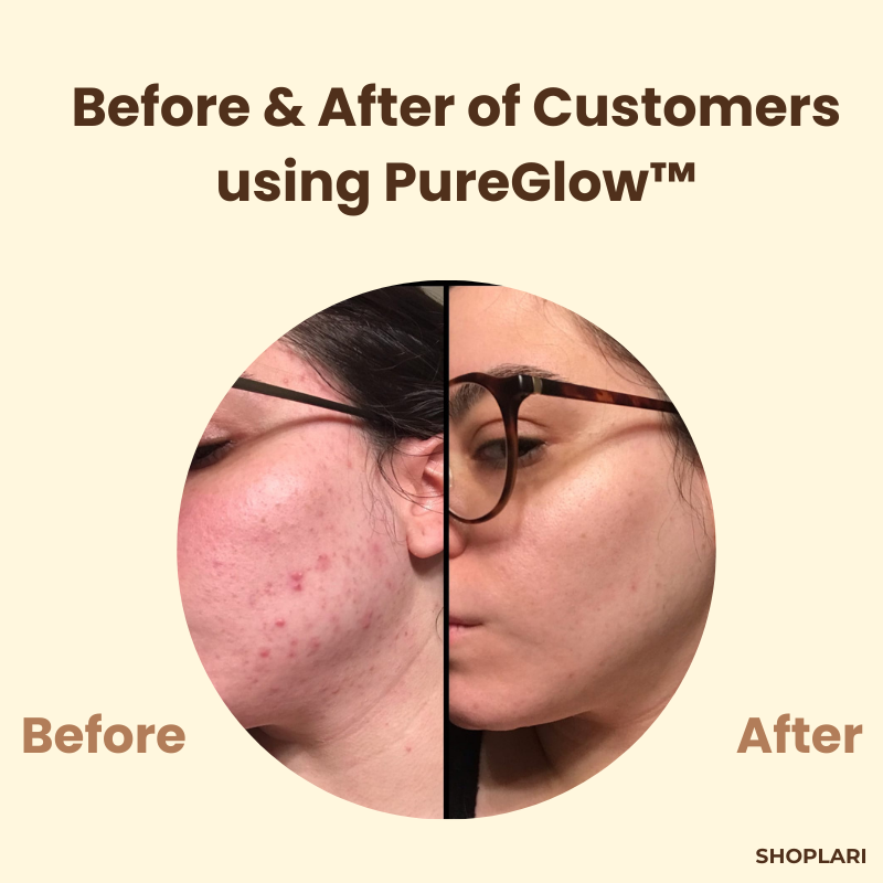 1+1 FREE | PureGlow™ Black Tea Mask