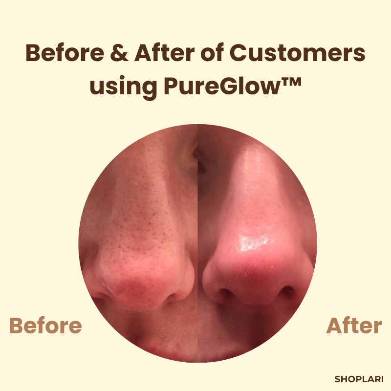1+1 FREE | PureGlow™ Black Tea Mask