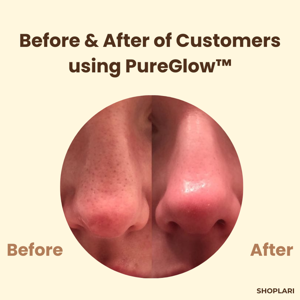 1+1 FREE | PureGlow™ Black Tea Mask