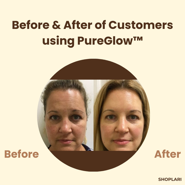 1+1 FREE | PureGlow™ Black Tea Mask