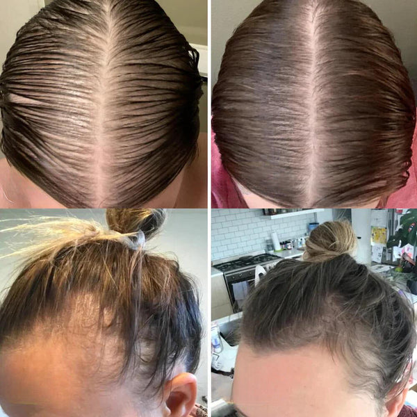 Minopia™ - A Holistic Formula Powered by Nature