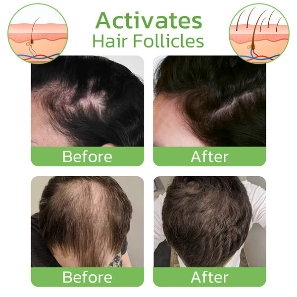 GrowthPlus™ Nourishing Ginger Spray