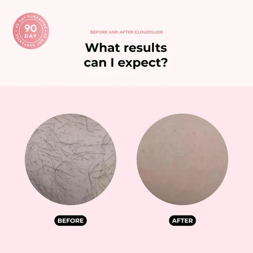 TrimFlex™ 2-in-1 Hair Shaver