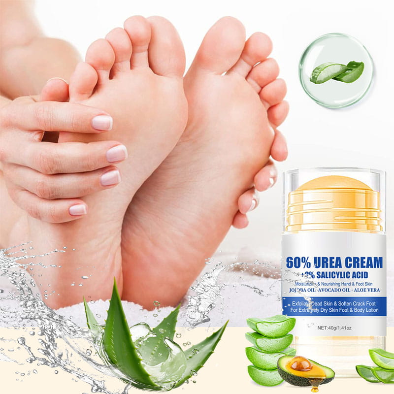 SoftStep™ Moisturizing and Anti-Crack Foot Cream