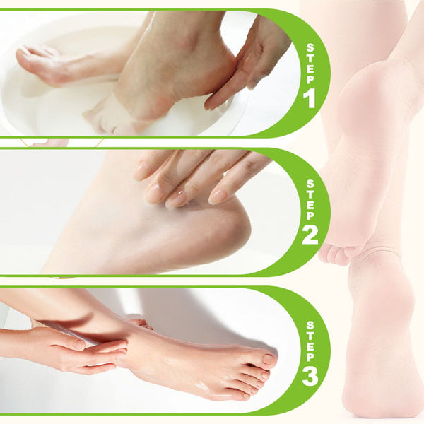 SoftStep™ Moisturizing and Anti-Crack Foot Cream